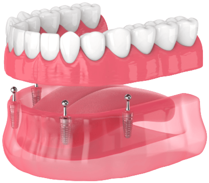 Commonly asked questions about dental check ups, Lotus Dental and Aesthetics Clinic, Golders Green
