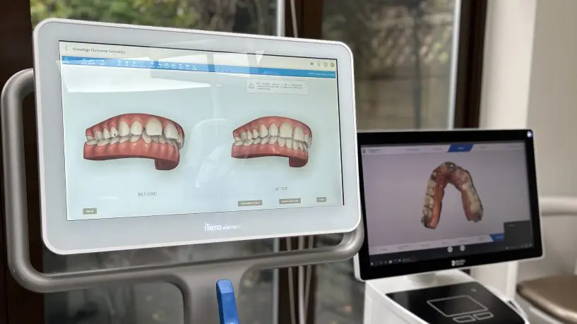 Teeth in a Day - Lotus Dental and Aesthetics Clinic
