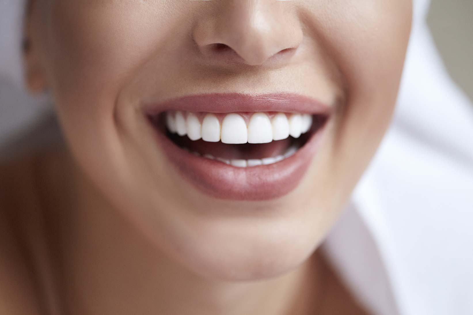 Composite Dental Veneers
