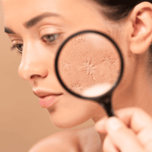 Dry Skin in Temperate Climates