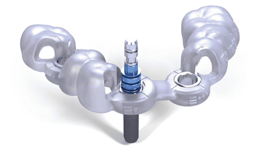 Fully Guided Implants