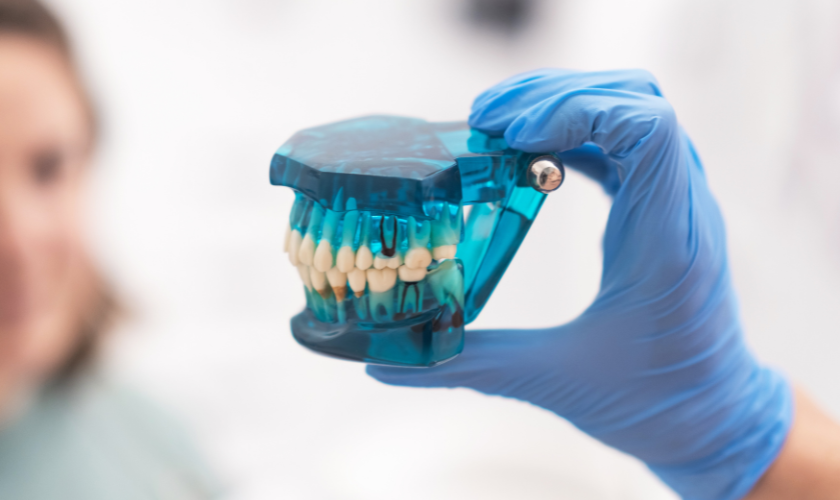 Modern Tooth Replacement Options