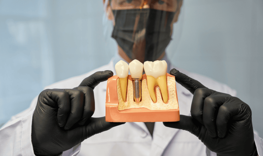 Dental Implants