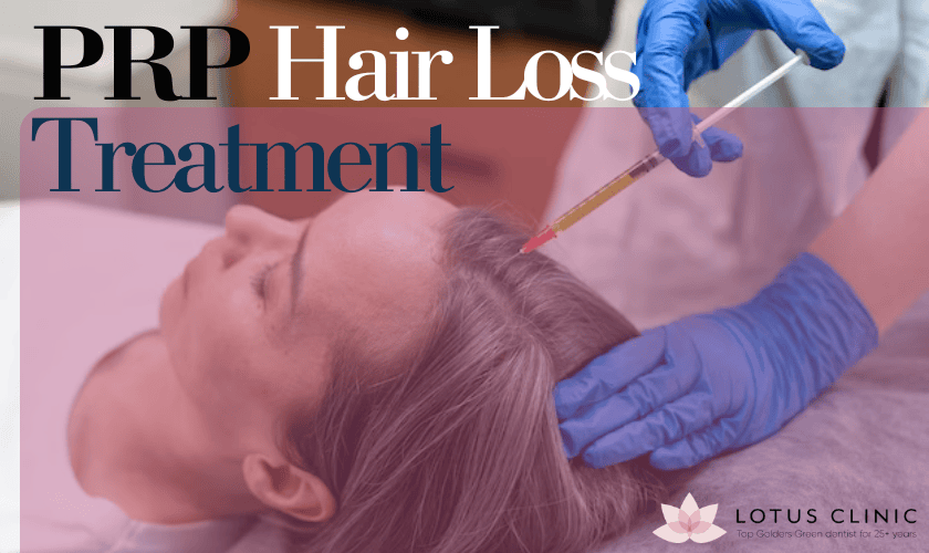PRP Therapy for hair loss