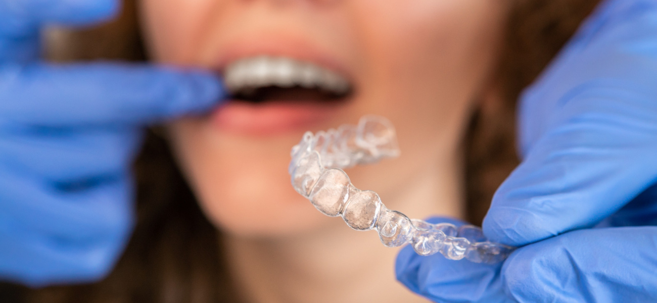 the essential guide to Invisalign aftercare