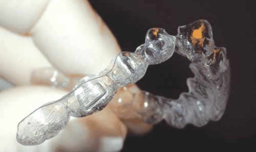 troubleshooting common aligner issues