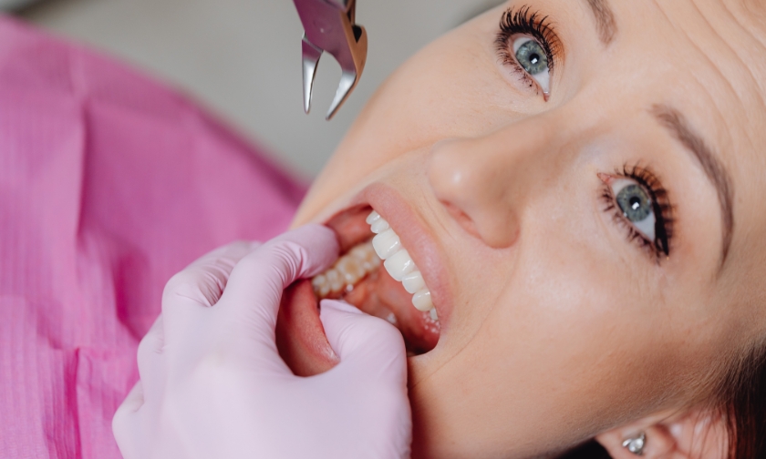tooth extraction for overall health